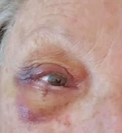 Resized_20221218_080730.jpeg Resized_20221218_080730.jpeg