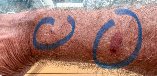 JP CM 6 Pete's Arm.jpg