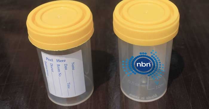 NBN-piss.jpg